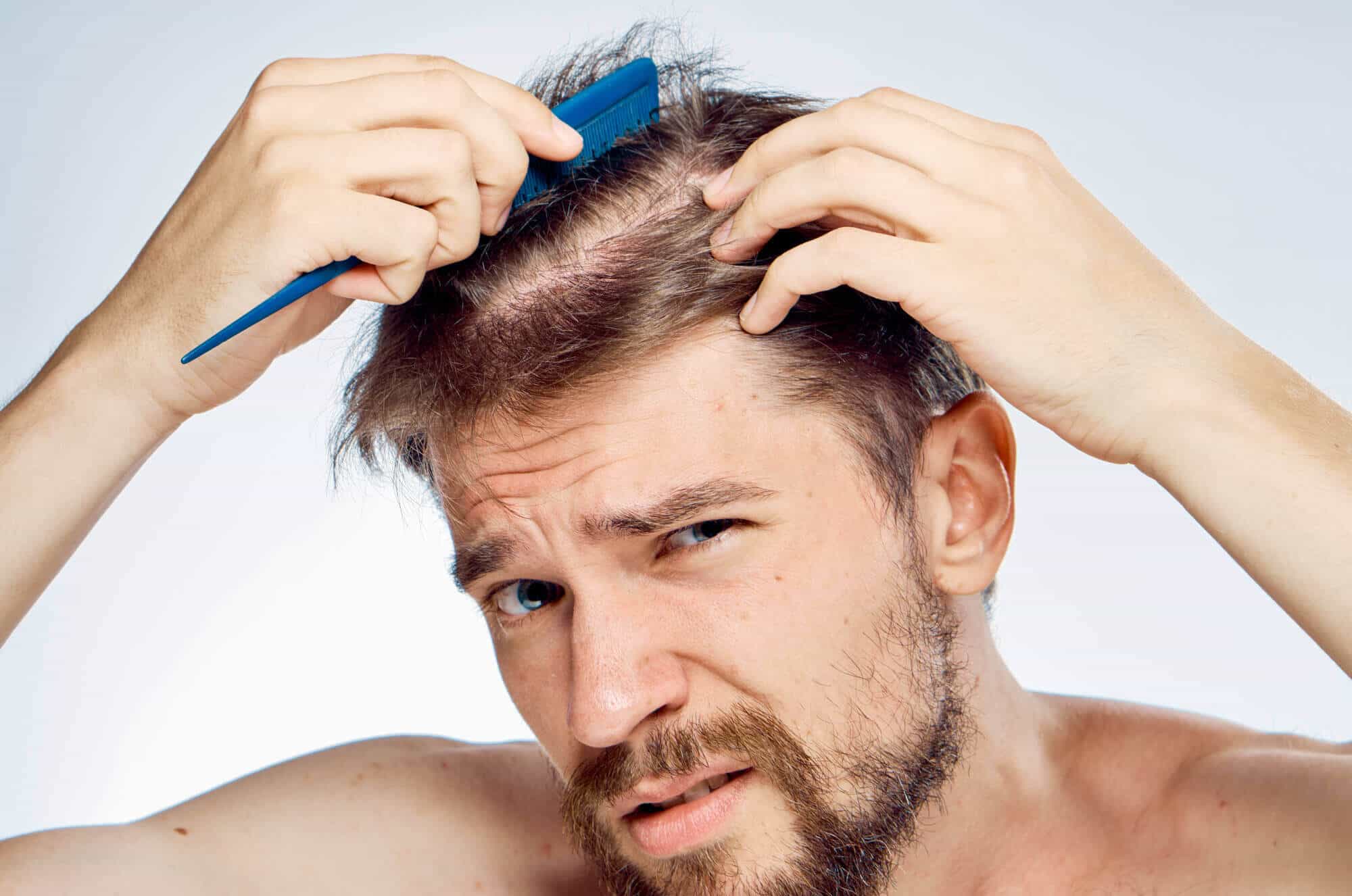 Five Ways to Truly Prevent Hair Loss That Anyone Can Try